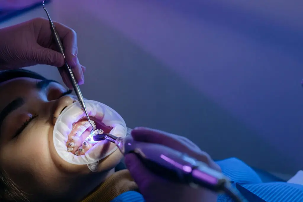 Dental treatment process focusing on orthodontic braces using UV light by a professional.